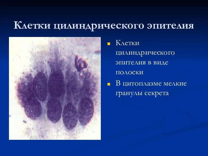 Клетки цилиндрического эпителия Клетки цилиндрического эпителия в виде полоски В цитоплазме мелкие гранулы секрета