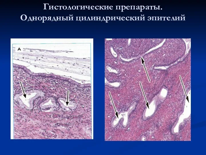 Гистологические препараты. Однорядный цилиндрический эпителий