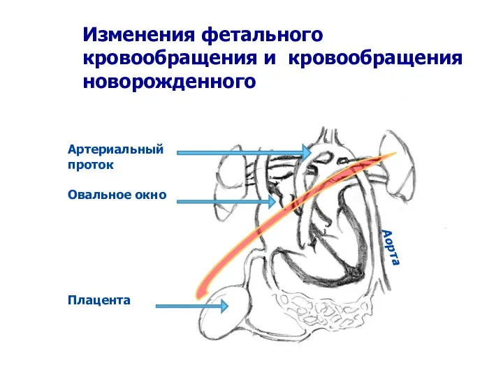 Изменения фетального кровообращения и кровообращения новорожденного