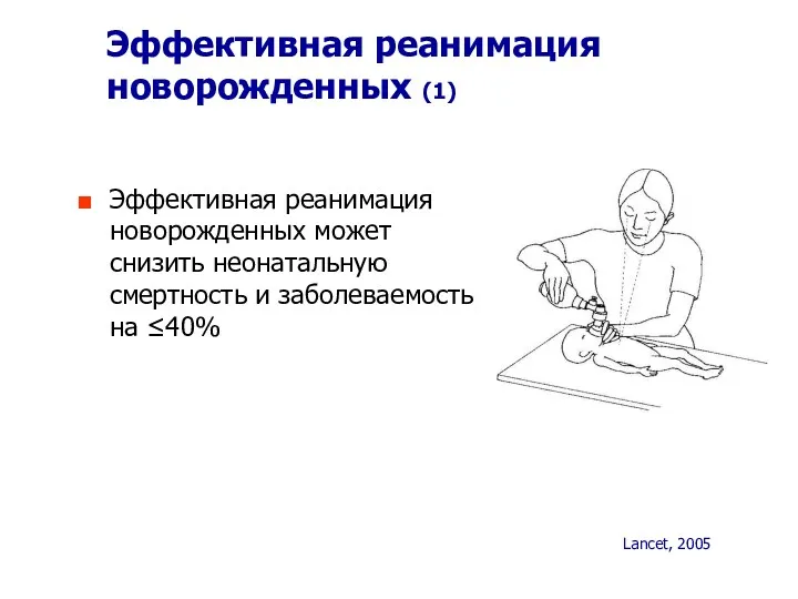 Эффективная реанимация новорожденных (1) Эффективная реанимация новорожденных может снизить неонатальную