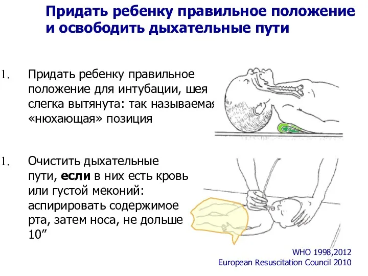 Придать ребенку правильное положение для интубации, шея слегка вытянута: так