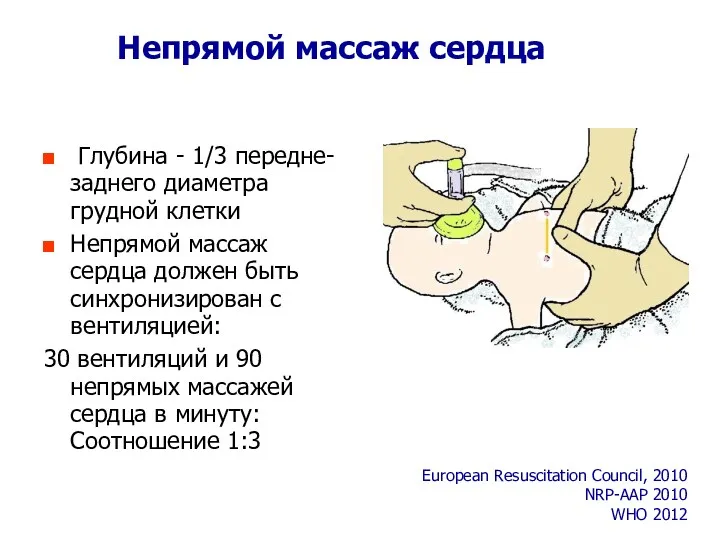 Непрямой массаж сердца Глубина - 1/3 передне-заднего диаметра грудной клетки