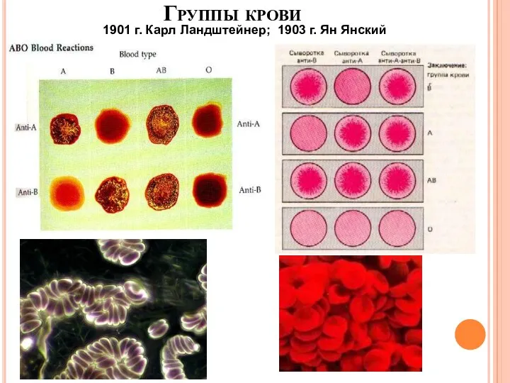 Группы крови 1901 г. Карл Ландштейнер; 1903 г. Ян Янский