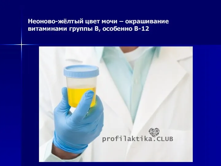 Неоново-жёлтый цвет мочи – окрашивание витаминами группы В, особенно В-12