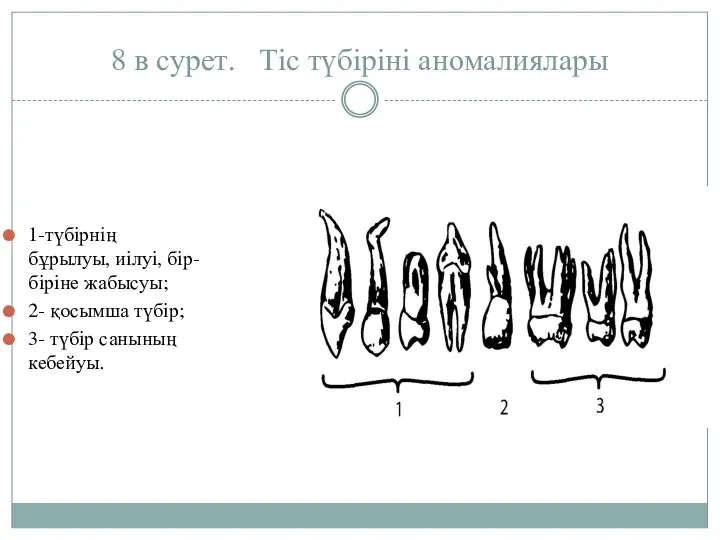 8 в сурет. Тiс түбiрiнi аномалиялары 1-түбiрнің бұрылуы, иiлуi, бiр-бiрiне