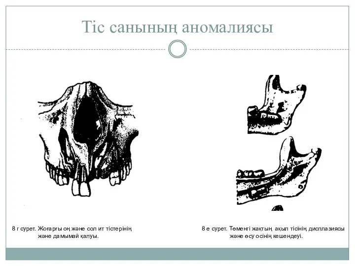 Тiс санының аномалиясы 8 г сурет. Жоғарғы оң және сол