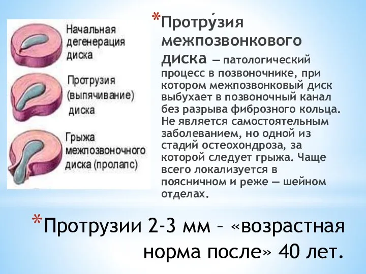 Протрузии 2-3 мм – «возрастная норма после» 40 лет. Протру́зия