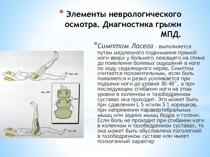 Элементы неврологического осмотра. Диагностика грыжи МПД. Симптом Ласега – выполняется