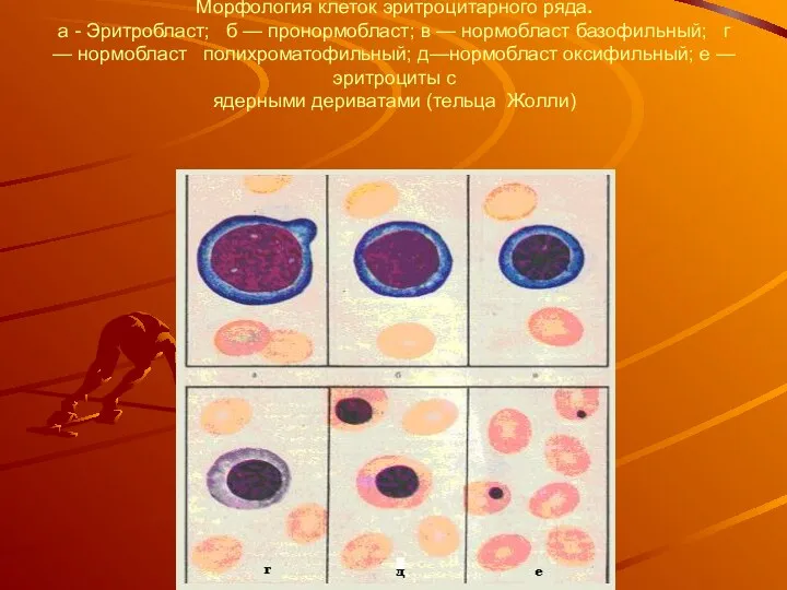 Морфология клеток эритроцитарного ряда. а - Эритробласт; б — пронормобласт;