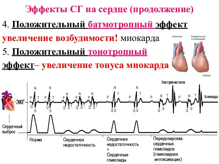 Эффекты СГ на сердце (продолжение) 4. Положительный батмотропный эффект увеличение