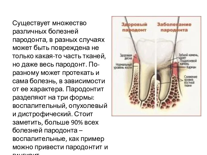 Существует множество различных болезней пародонта, в разных случаях может быть