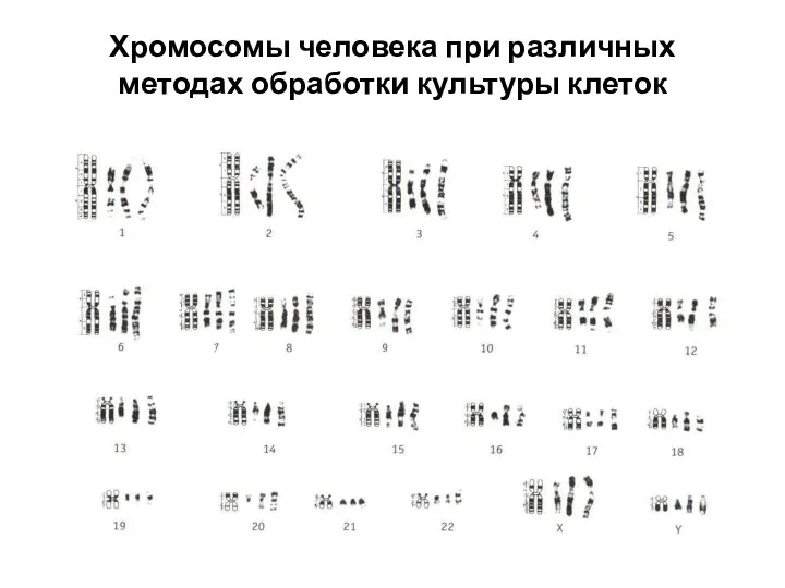 Хромосомы человека при различных методах обработки культуры клеток