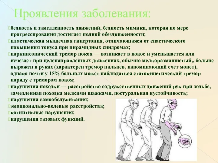 Проявления заболевания: бедность и замедленность движений, бедность мимики, которая по мере прогрессирования достигает