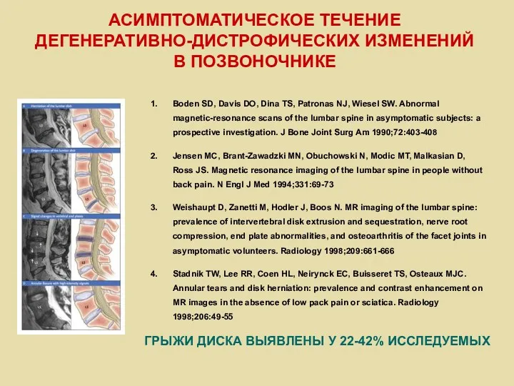 Boden SD, Davis DO, Dina TS, Patronas NJ, Wiesel SW. Abnormal magnetic-resonance scans