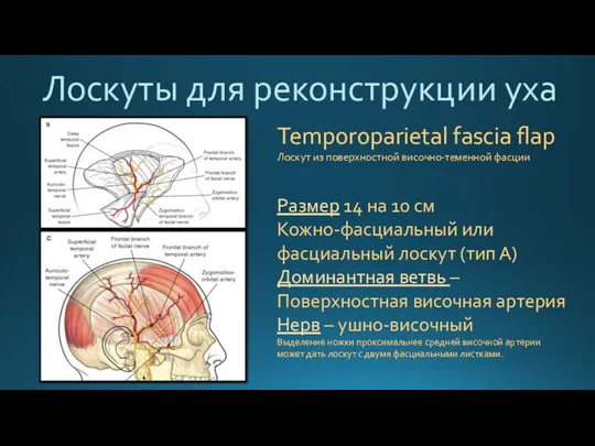 Лоскуты для реконструкции уха Temporoparietal fascia flap Лоскут из поверхностной