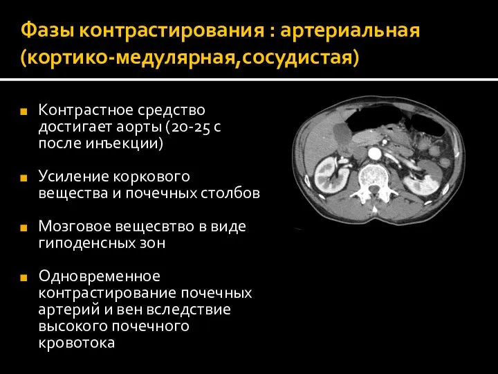 Фазы контрастирования : артериальная (кортико-медулярная,сосудистая) Контрастное средство достигает аорты (20-25