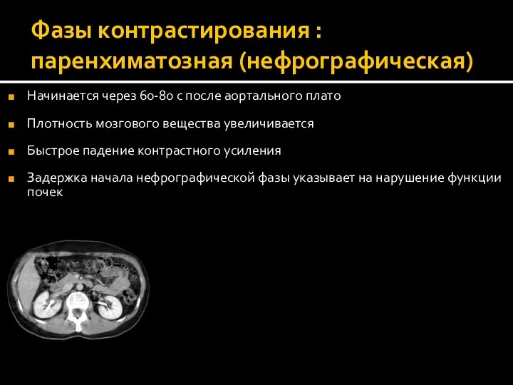 Фазы контрастирования : паренхиматозная (нефрографическая) Начинается через 60-80 с после