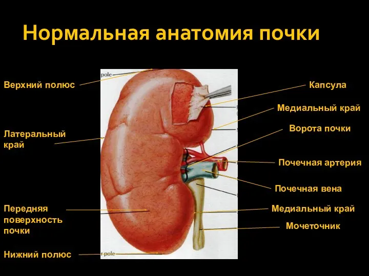 Нормальная анатомия почки Мочеточник Почечная артерия Почечная вена Ворота почки