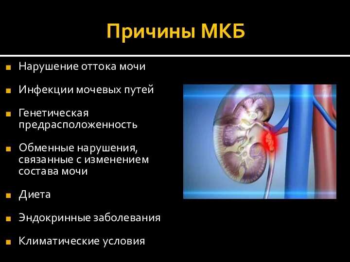 Причины МКБ Нарушение оттока мочи Инфекции мочевых путей Генетическая предрасположенность