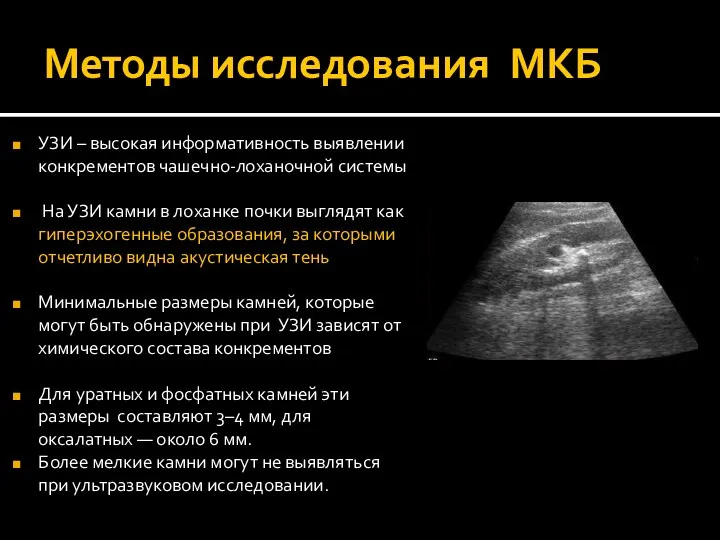 Методы исследования МКБ УЗИ – высокая информативность выявлении конкрементов чашечно-лоханочной