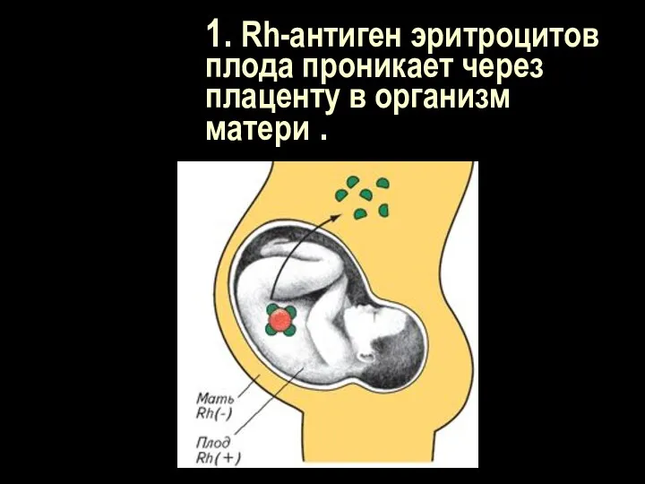 1. Rh-антиген эритроцитов плода проникает через плаценту в организм матери .