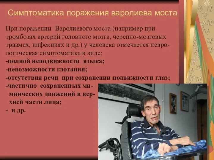 Симптоматика поражения варолиева моста При поражении Варолиевого моста (например при тромбозах артерий головного