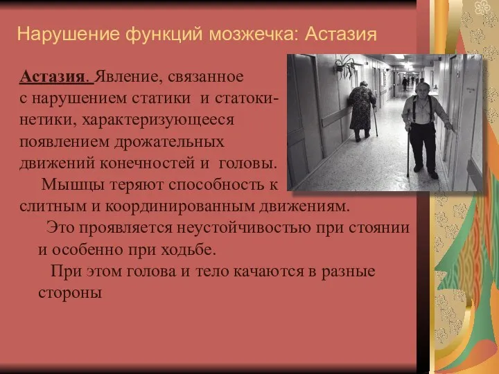 Нарушение функций мозжечка: Астазия Астазия. Явление, связанное с нарушением статики и статоки- нетики,