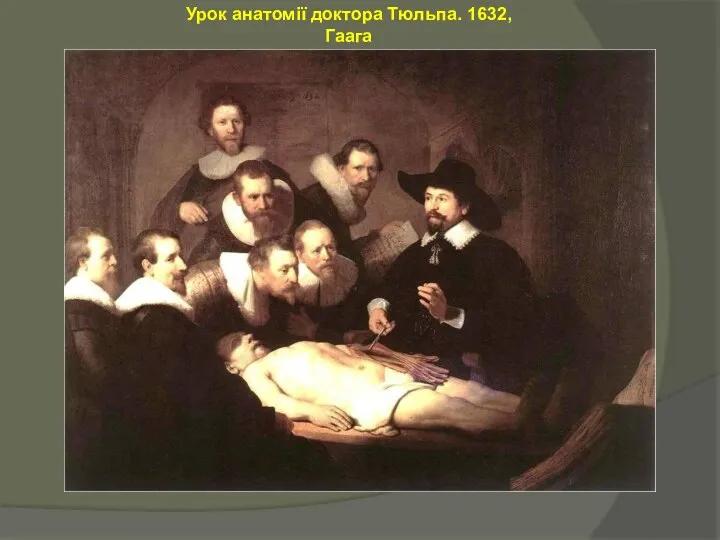 Урок анатомії доктора Тюльпа. 1632, Гаага