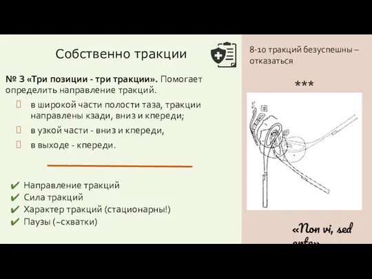 Собственно тракции № З «Три позиции - три тракции». Помогает