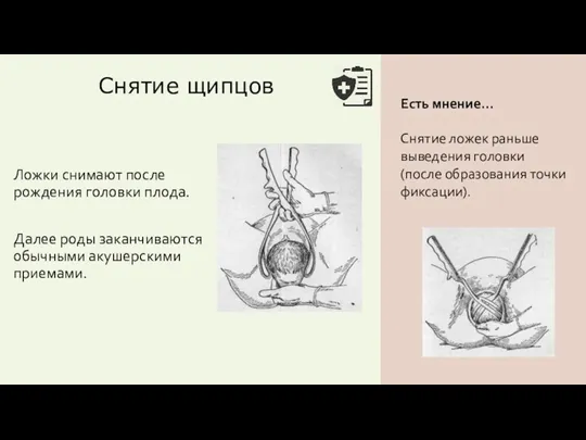 Снятие щипцов Ложки снимают после рождения головки плода. Далее роды