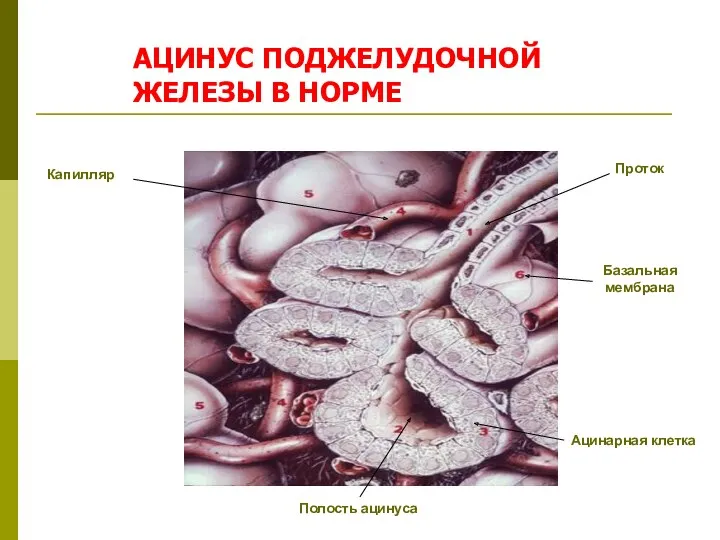 АЦИНУС ПОДЖЕЛУДОЧНОЙ ЖЕЛЕЗЫ В НОРМЕ Базальная мембрана Ацинарная клетка Полость ацинуса Проток Капилляр