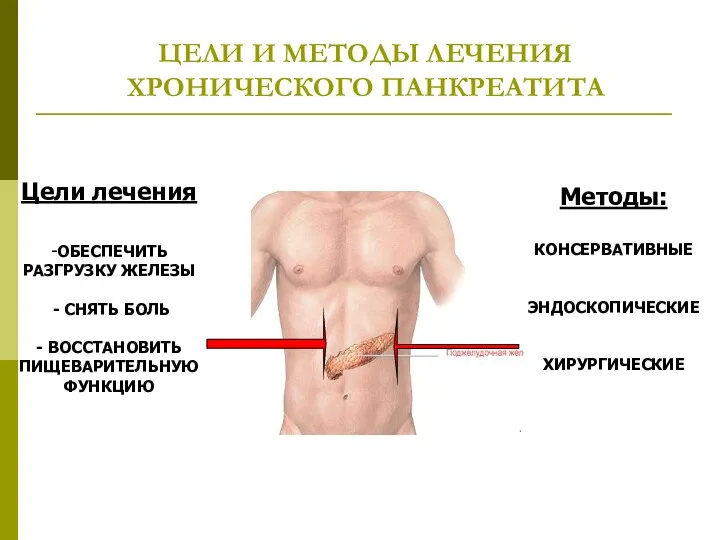 ЦЕЛИ И МЕТОДЫ ЛЕЧЕНИЯ ХРОНИЧЕСКОГО ПАНКРЕАТИТА Методы: КОНСЕРВАТИВНЫЕ ЭНДОСКОПИЧЕСКИЕ ХИРУРГИЧЕСКИЕ