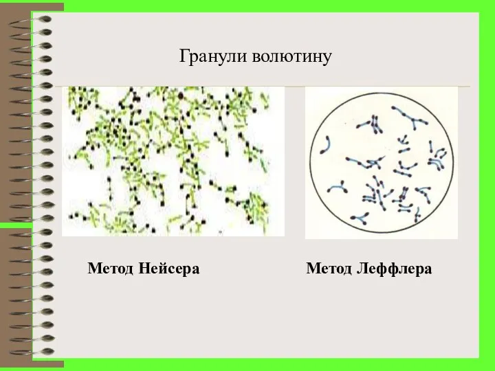 Гранули волютину Метод Леффлера Метод Нейсера