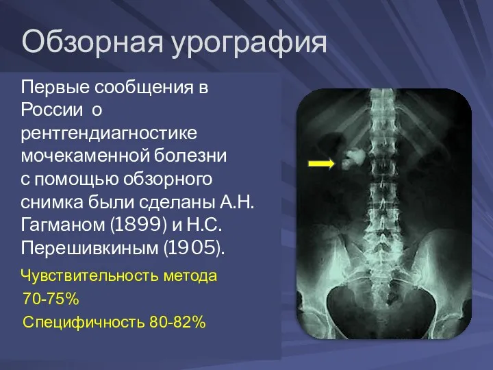 Обзорная урография Первые сообщения в России о рентгендиагностике мочекаменной болезни с помощью обзорного