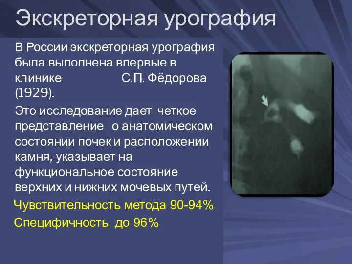 Экскреторная урография В России экскреторная урография была выполнена впервые в клинике С.П. Фёдорова
