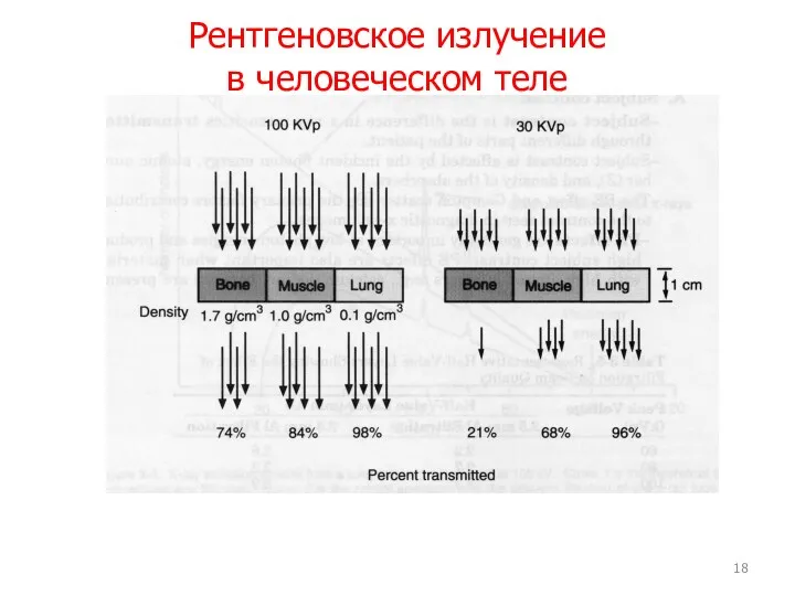 Рентгеновское излучение в человеческом теле