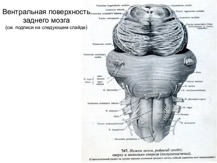 Вентральная поверхность заднего мозга (см. подписи на следующем слайде)