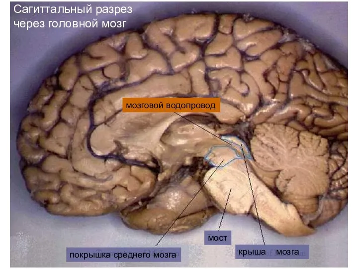 Сагиттальный разрез через головной мозг мозговой водопровод покрышка среднего мозга мост крыша мозга