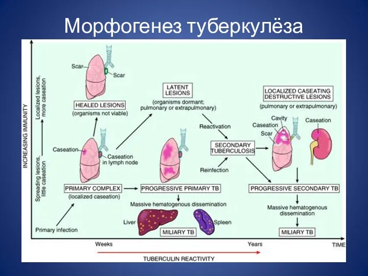Морфогенез туберкулёза