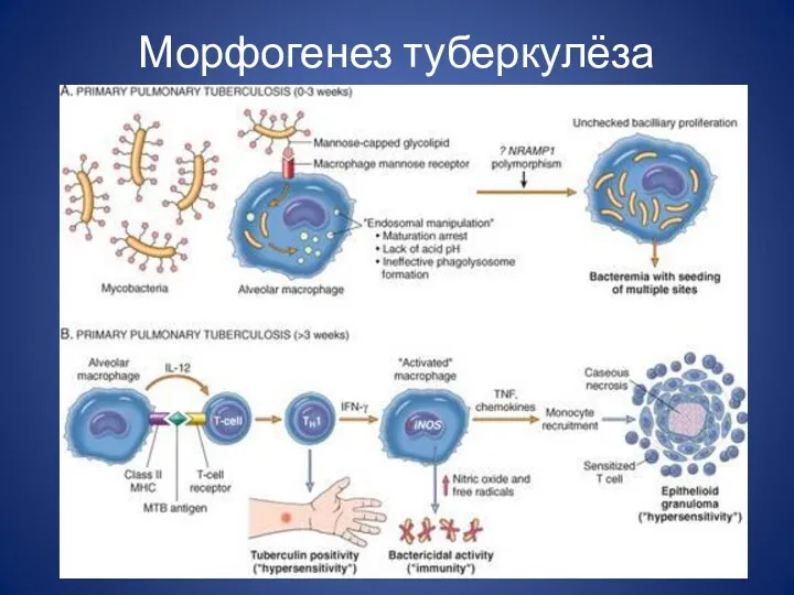 Морфогенез туберкулёза