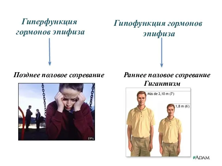 Гиперфункция гормонов эпифиза Гипофункция гормонов эпифиза Позднее половое созревание Раннее половое созревание Гигантизм