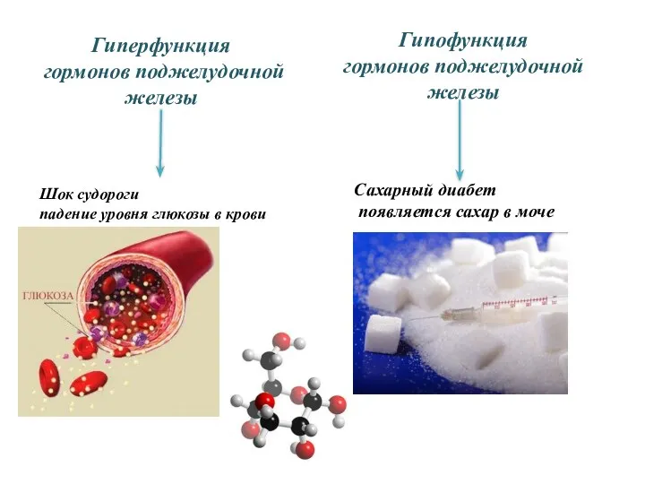 Гиперфункция гормонов поджелудочной железы Шок судороги падение уровня глюкозы в