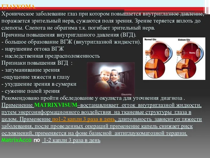 ГЛАУКОМА. Хроническое заболевание глаз при котором повышается внутриглазное давление, поражается зрительный нерв, сужаются