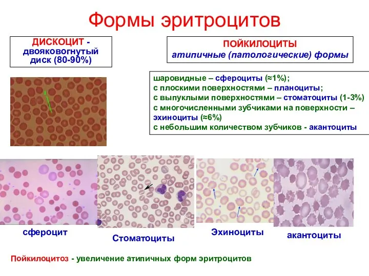 Формы эритроцитов ДИСКОЦИТ - двояковогнутый диск (80-90%) ПОЙКИЛОЦИТЫ атипичные (патологические)