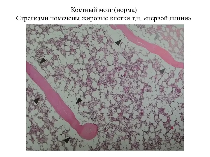 Костный мозг (норма) Стрелками помечены жировые клетки т.н. «первой линии»