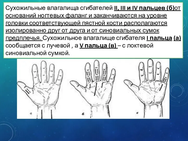 Сухожильные влагалища сгибателей II, III и IV пальцев (б)от оснований