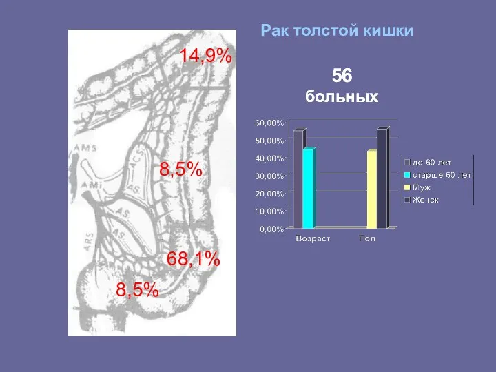 14,9% 8,5% 68,1% 8,5% 56 больных 56 больных Рак толстой кишки