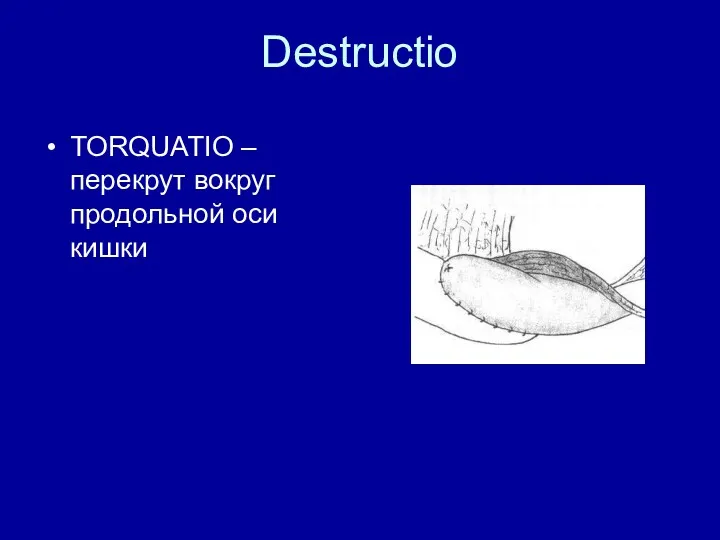 Destructio TORQUATIO – перекрут вокруг продольной оси кишки