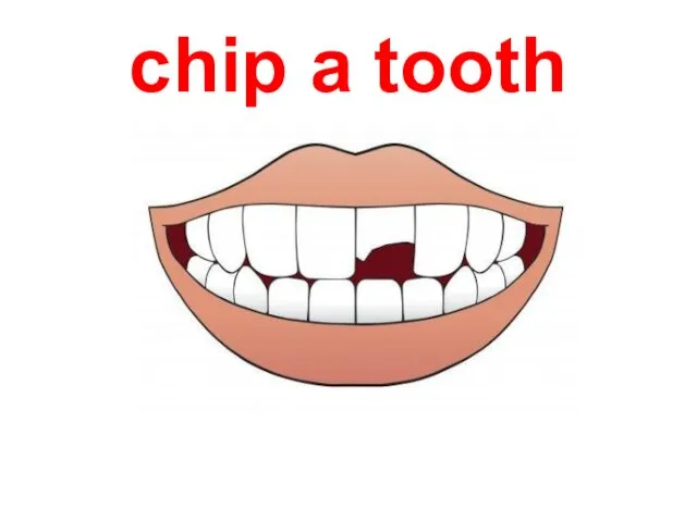 chip a tooth