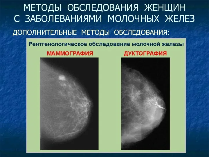 Рентгенологические Ультразвуковое сканирование Биопсия (пункционная, инцизионная, эксцизионная) Цитологическое исследование выделений